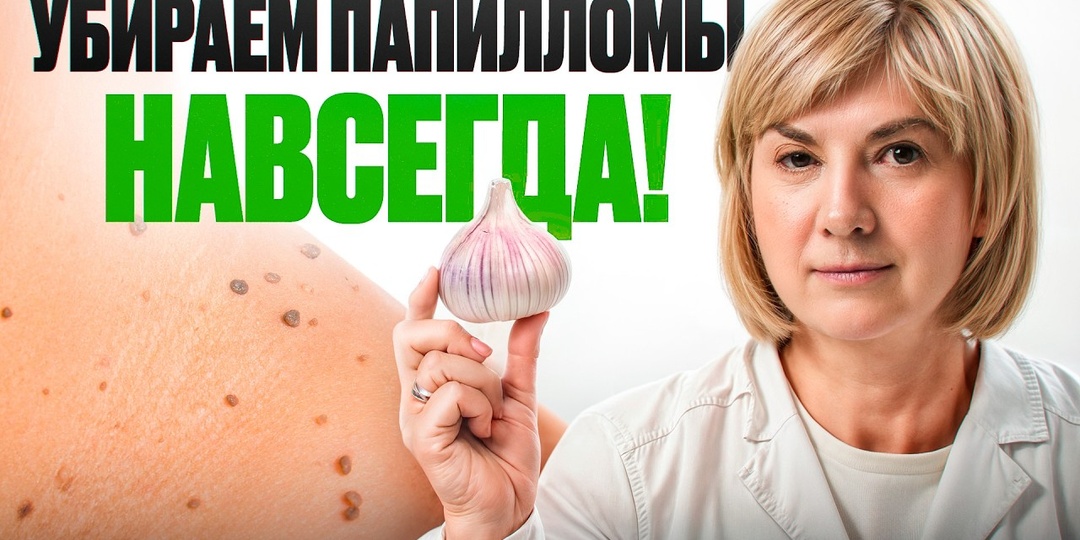 Папилломы, бородавки и другие образования на коже боятся этого средства!