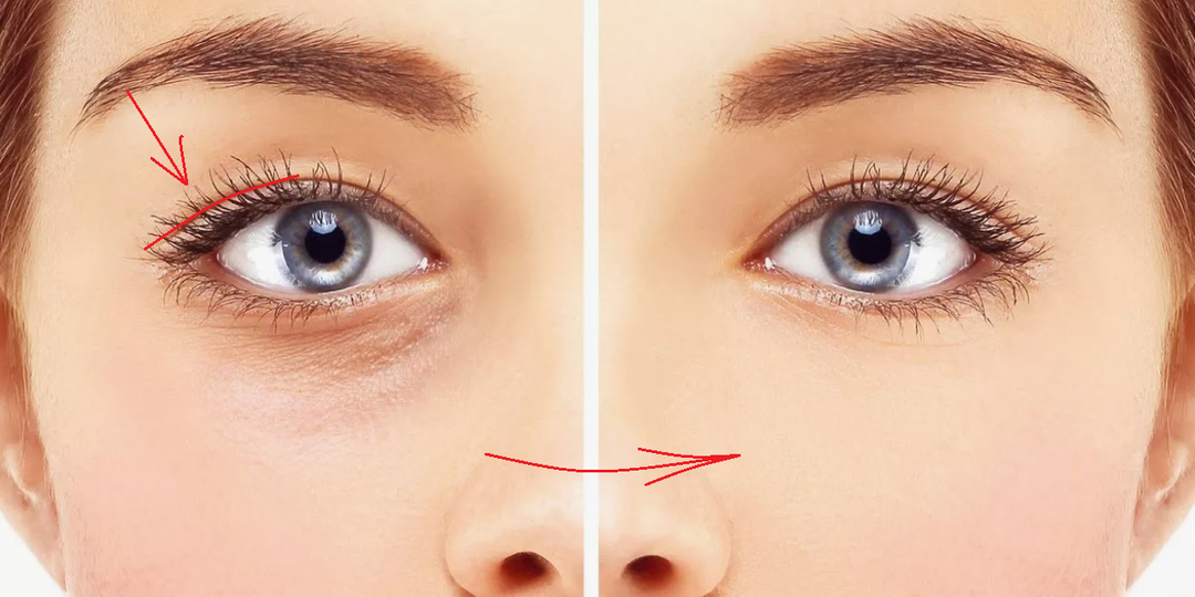У меня всегда глаза распахнуты без нависшх век: просто сдвигайте кожу головы