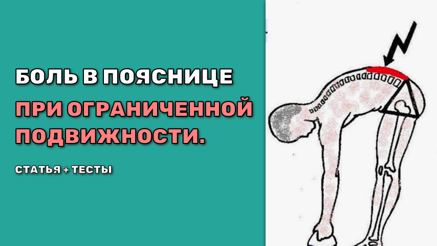 Скованность и снижение гибкости в нижней части позвоночника при наклонах и поворотах.