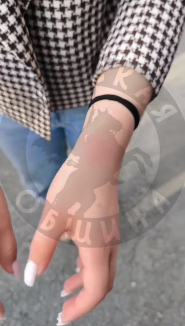 Фотография следов на запястье девушки