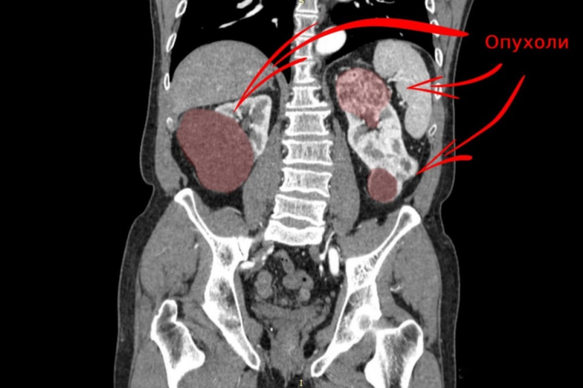    Фото: министерство здравоохранения Свердловской области