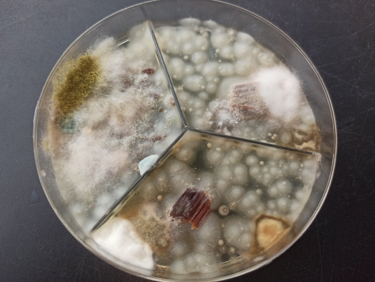 Вот так выглядит чашка Петри с выросшей на образцах плесенью