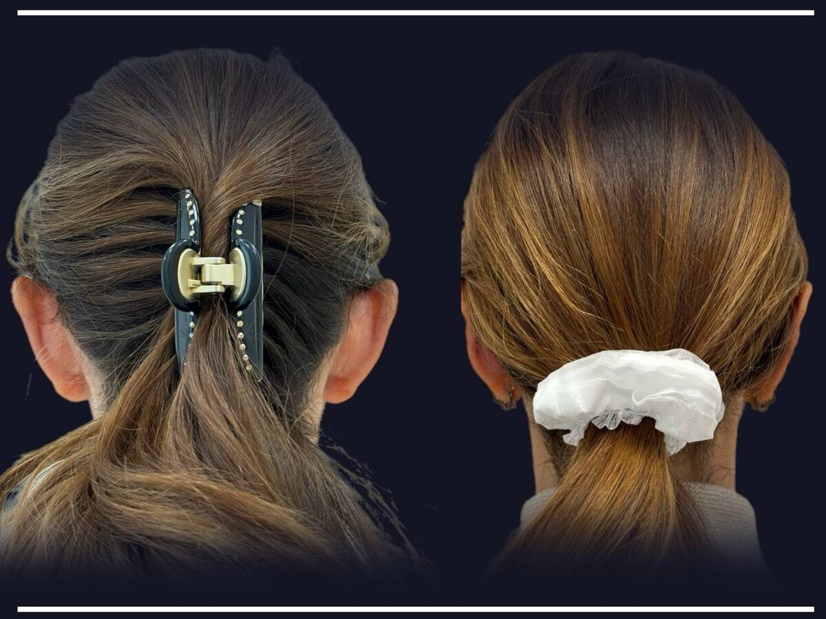 До\После. 1 мес с момента операции