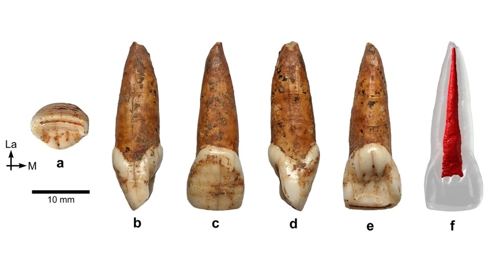   Predrag Radović et al. / American Journal of Biological Anthropology, 2025