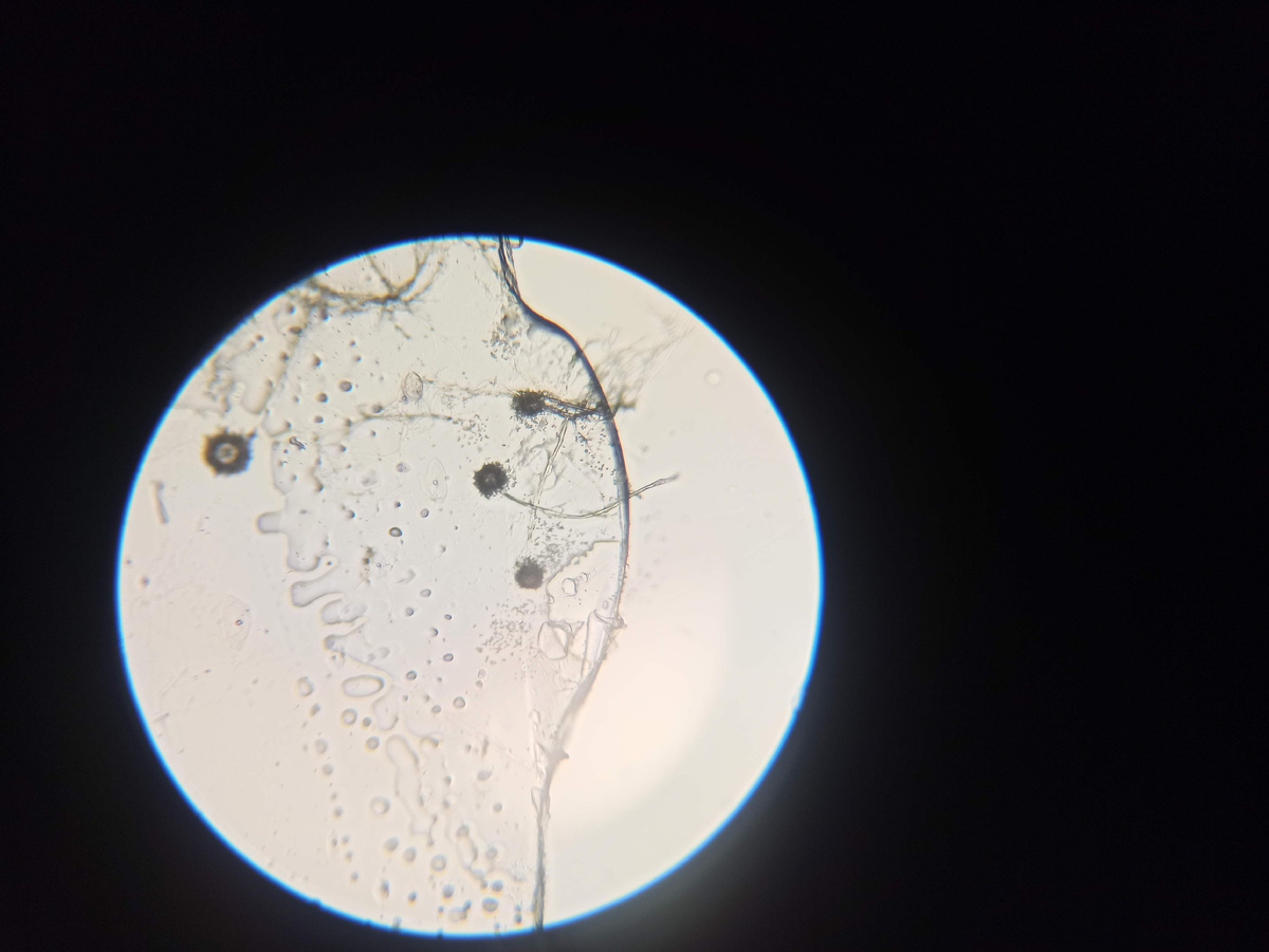 Плесневые грибы под микроскопом