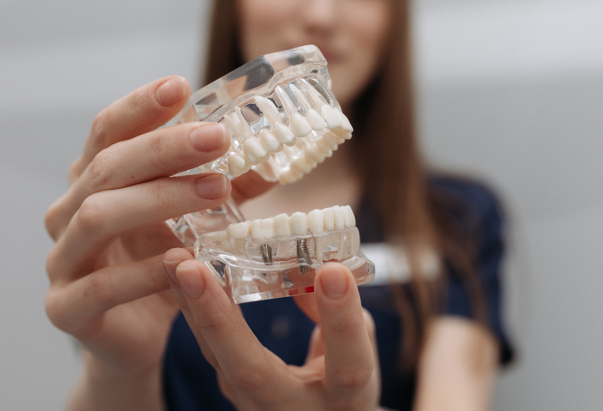 Имплантация сегодня считается самым эффективным методом восстановления отсутствующего зуба.