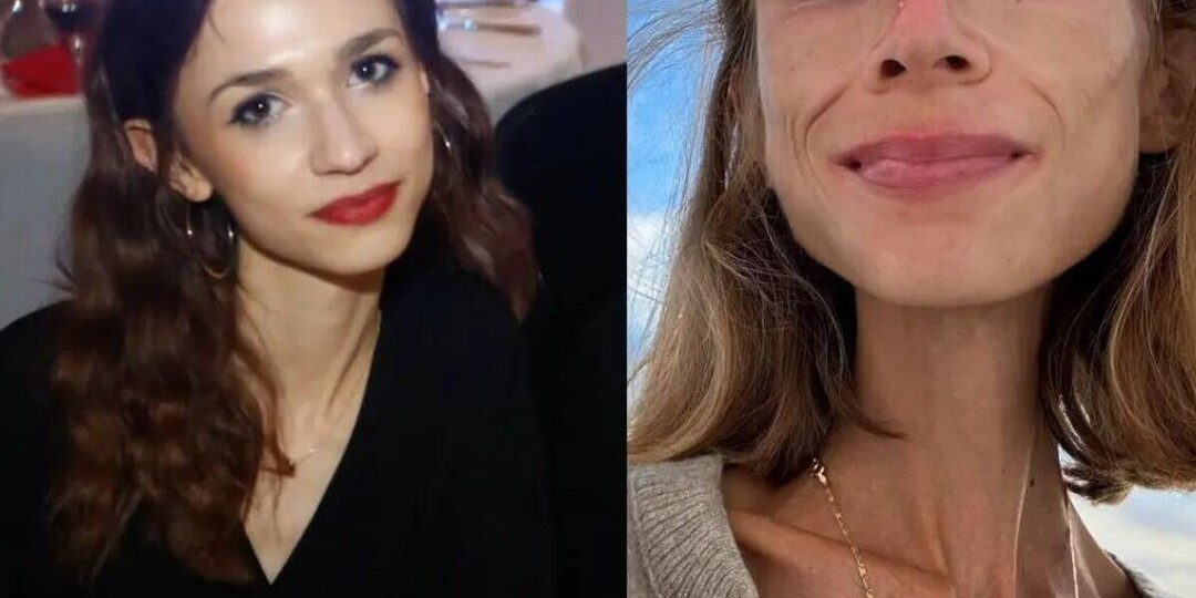 Весила 23 килограмма и годами ела только одно: диета убила молодую девушку в 27 лет! Последние фото испугали людей