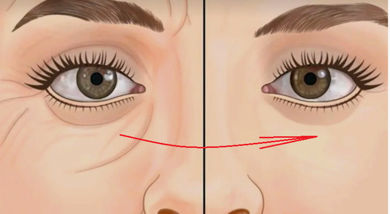 У меня всегда глаза без отеков, а взгляд распахнутый: какой быстрый комплекс я чаще всего использую