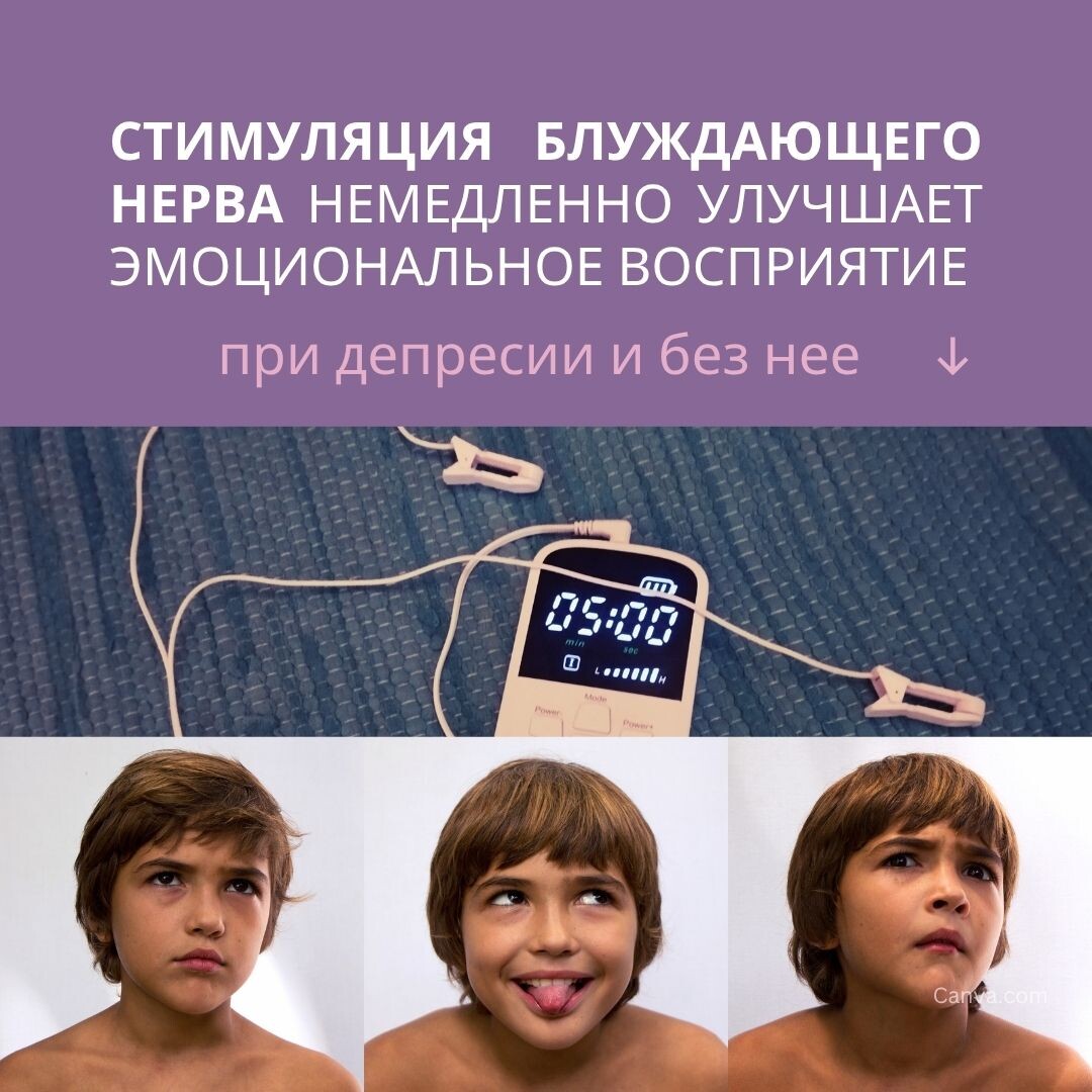 Стимуляция блуждающего нерва немедленно улучшает эмоциональное  восприятие