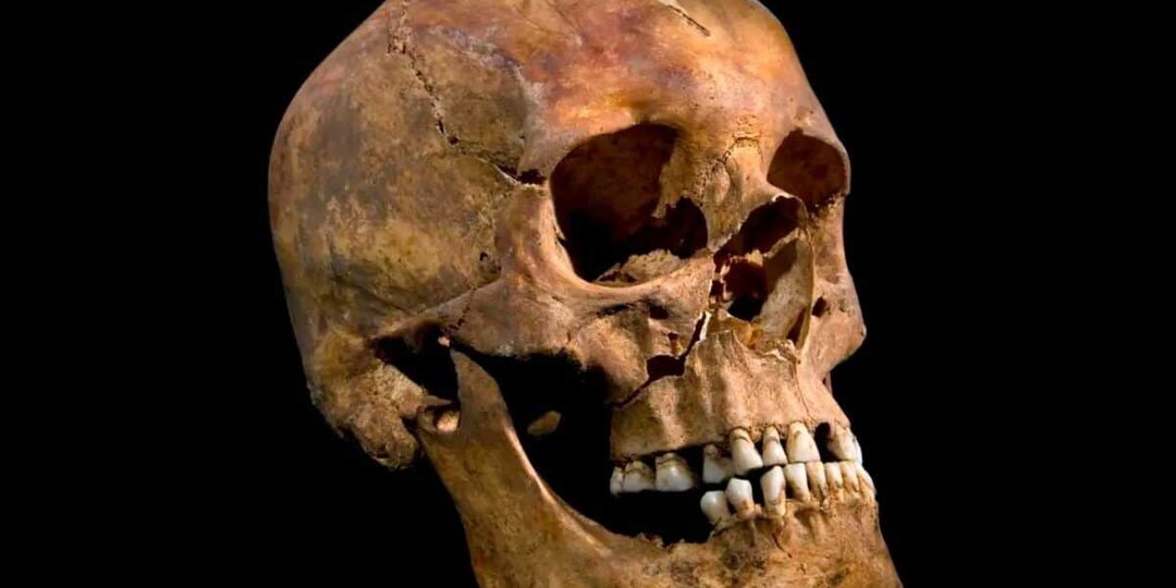 Микробиом полости рта короля Ричарда III рассказал о его здоровье