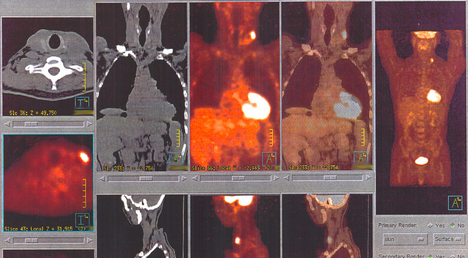   OpenStax College / Wikimedia Commons / CC-BY-3.0