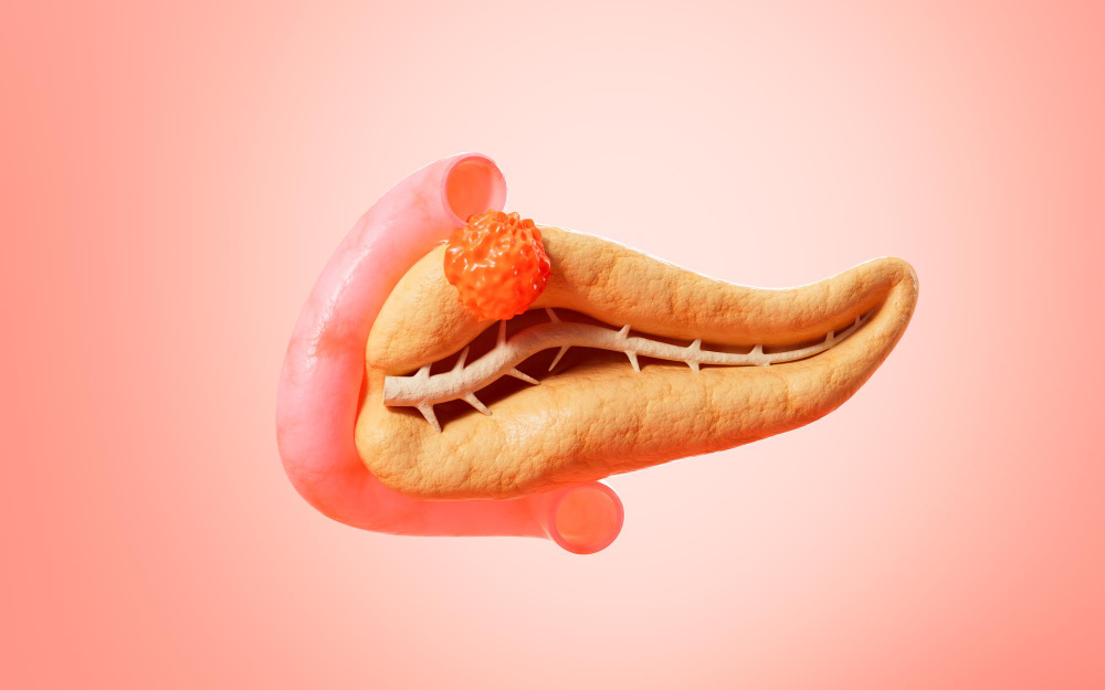 Панкреатит. (источник изображения: freepik.com)