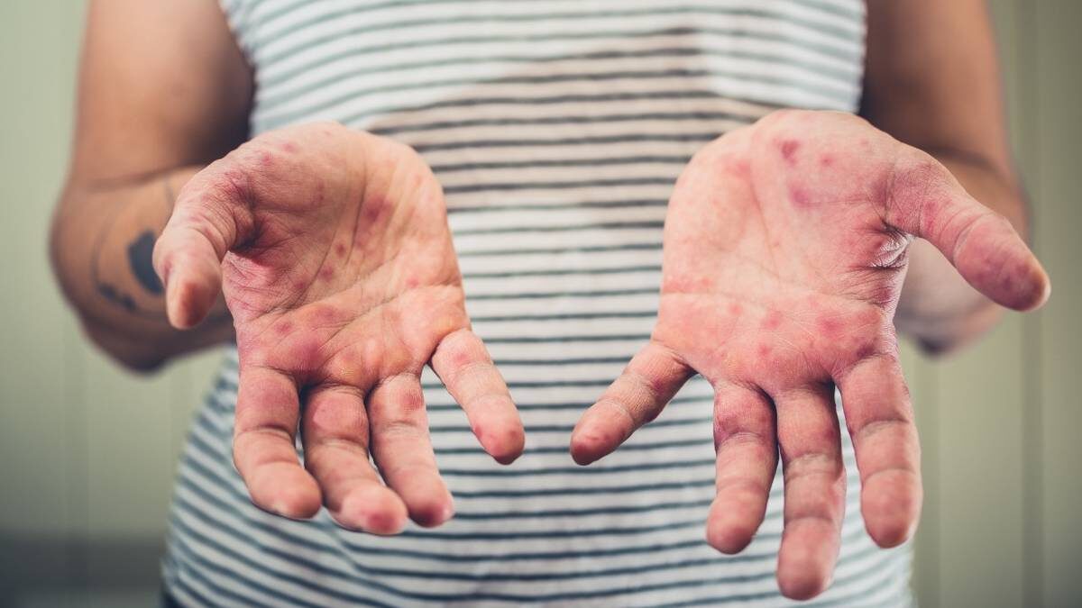    Фото: shutterstock