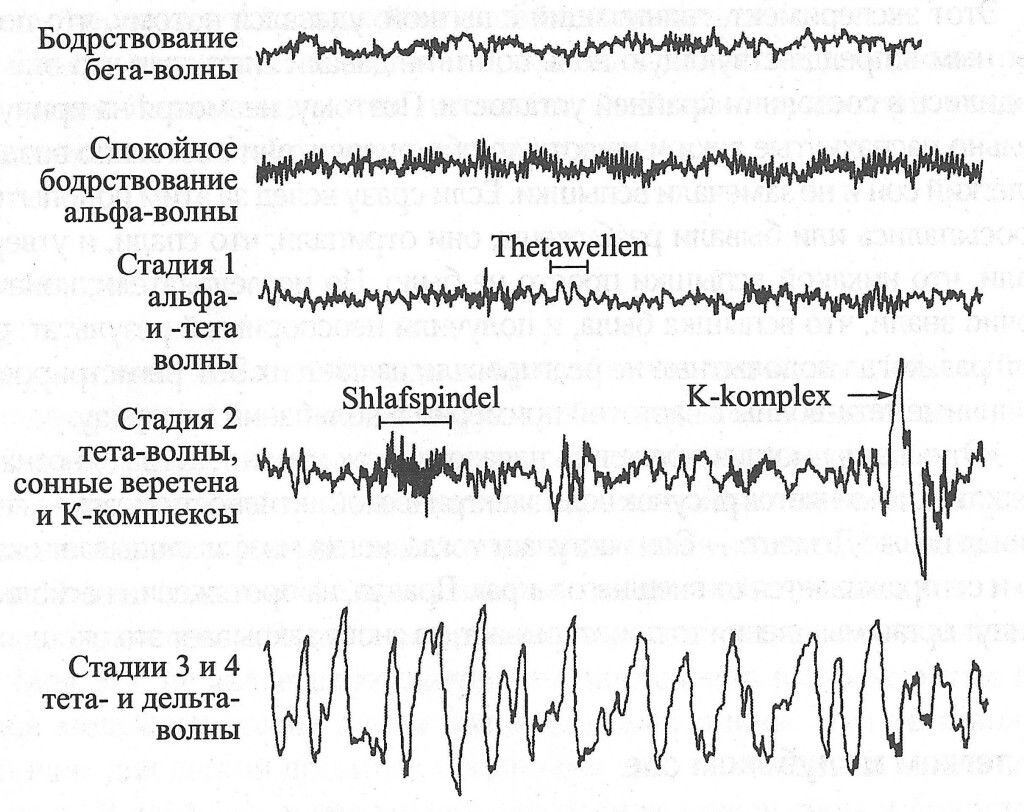 Различия в активности мозга во время сна на электроэнцефалограмме