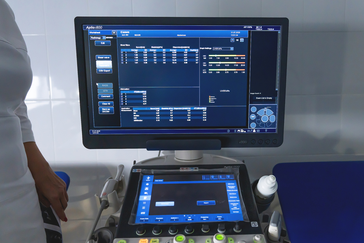 Эластометрия