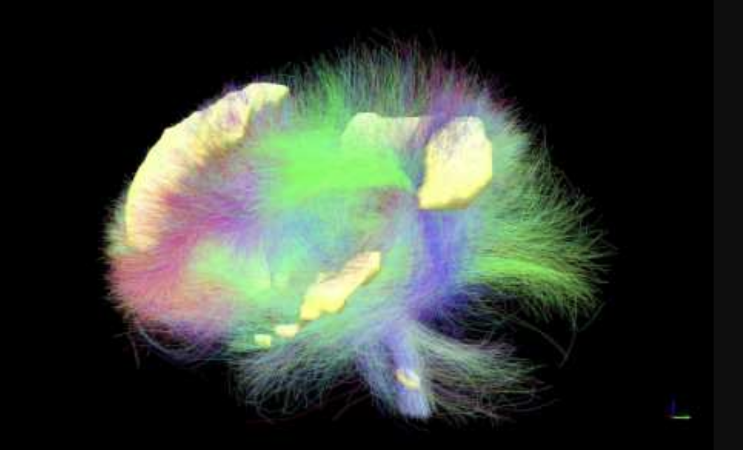 Сеть мозга, которая работает постоянно, поддерживая наш спонтанный поток сознания.