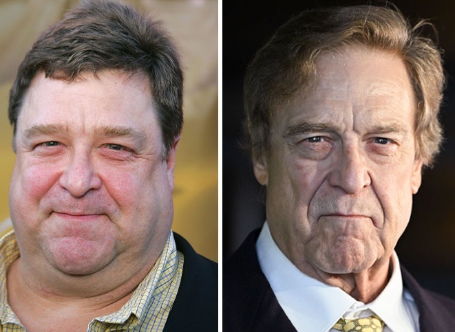 "Оземпиковое лицо" 