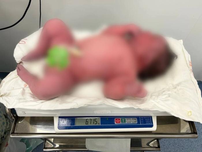 Сразу после родов девочку положили на весы. Фото © VK / Республикaнский перинатальный центр Эхын Баяр