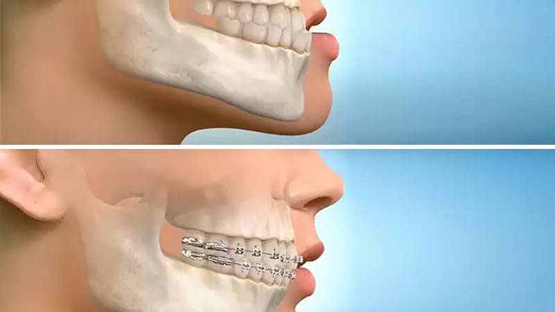 Стоматология Премоляр