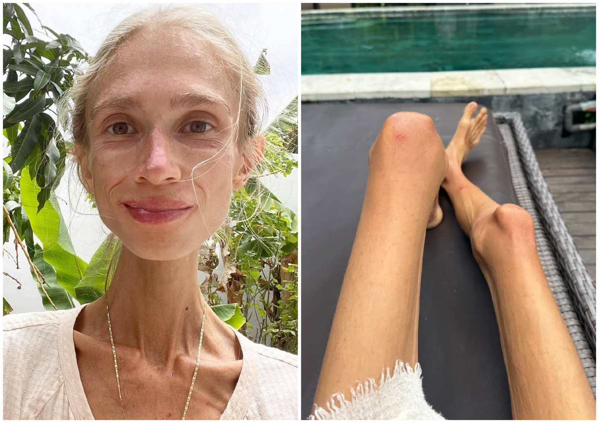 фото из сети. Каролина после