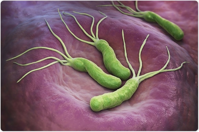 Инфекция H. pylori: симптомы, причины, диагностика и лечение