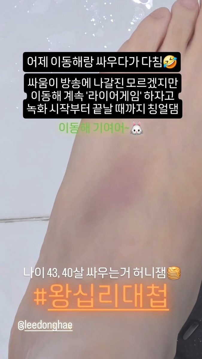    Хичоль из Super Junior показал синяк