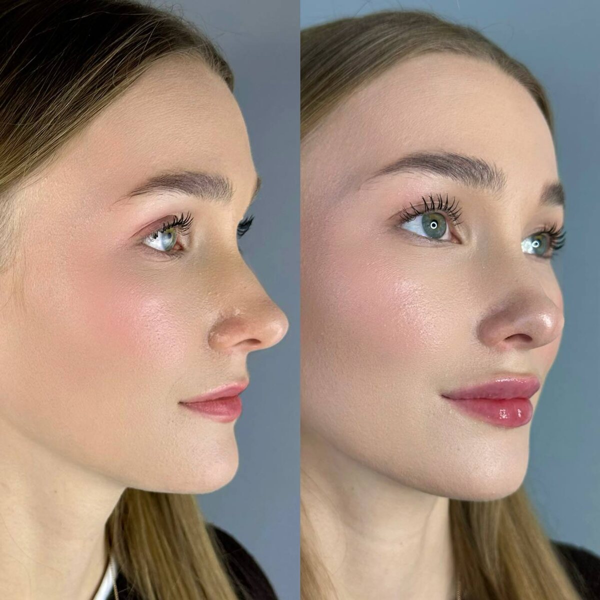 после спустя 7 дней