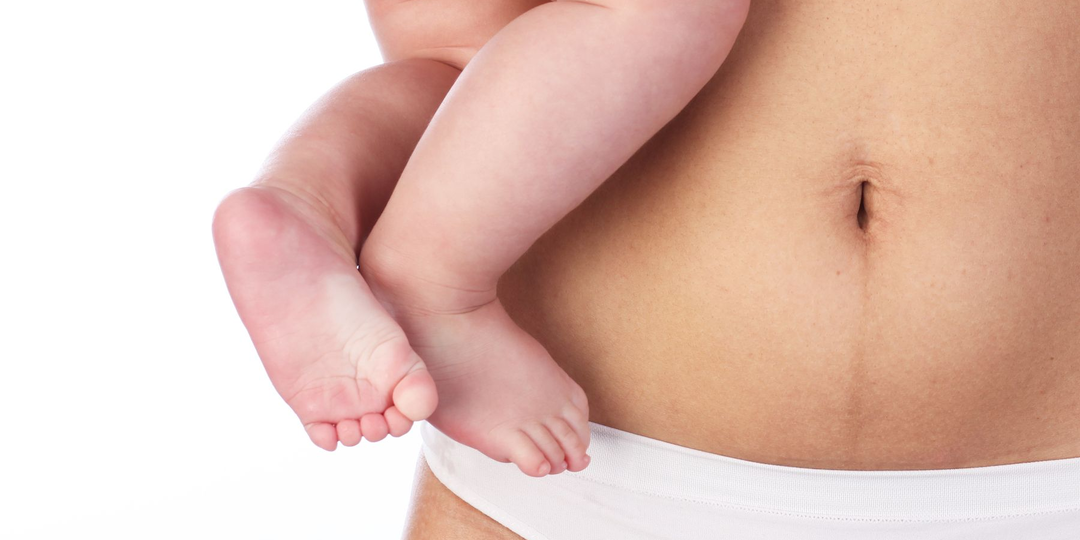 Как быстро восстанавливается женский организм после родов? Как вернуть фигуру