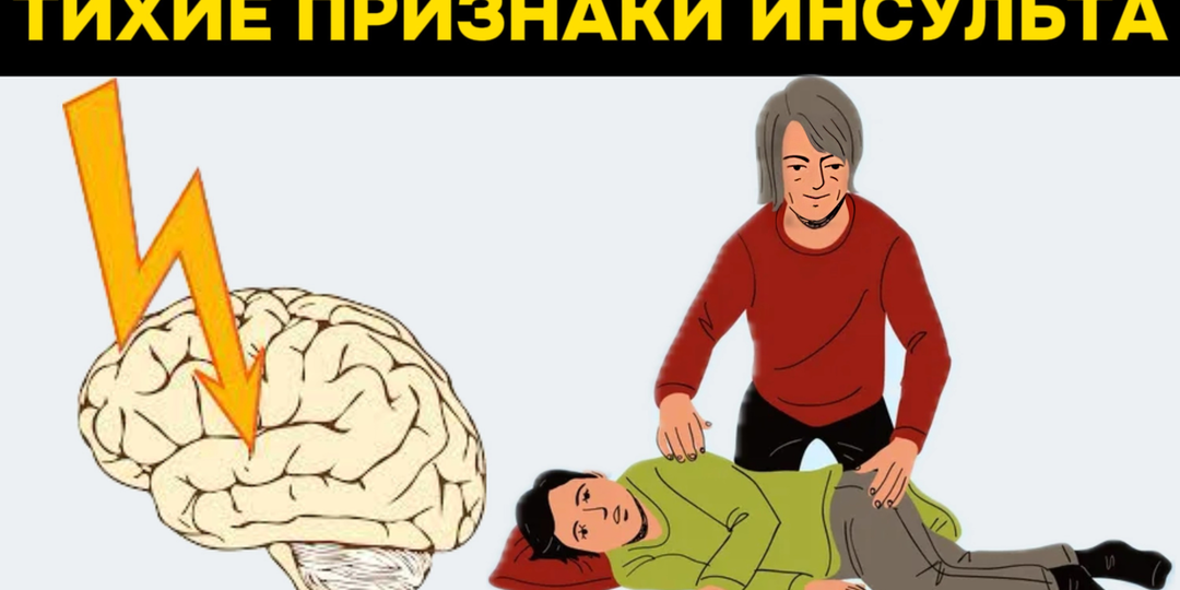 Рейтинг нейробиологов: 8 тихих предвестников инсульта