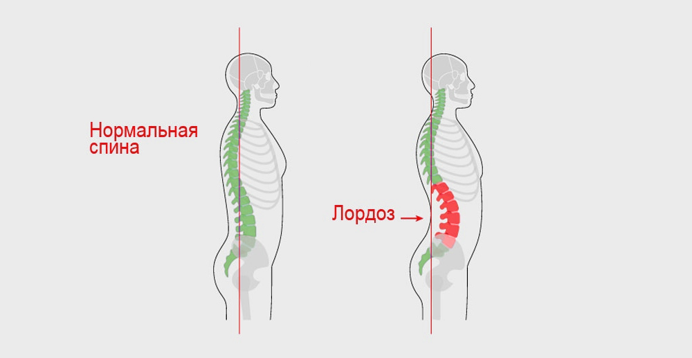 Женское здоровье, изначальная энергия и запуск через работу с сосудами