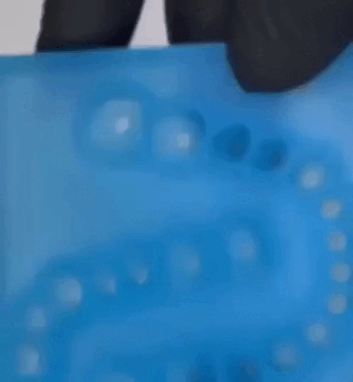 Один из вариантов изготовления временного индивидуального формирователя десны