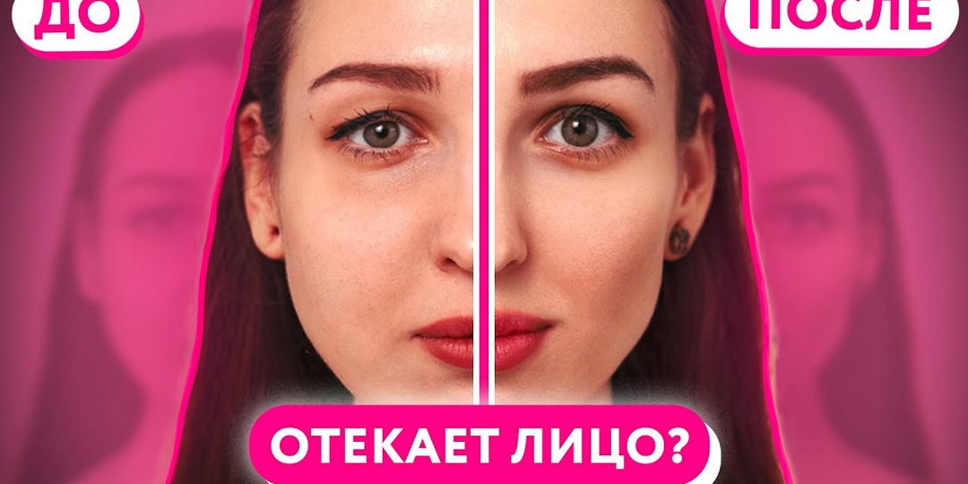 Как убрать отёчность лица утром