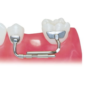 Ортодонтические держатели места зуба