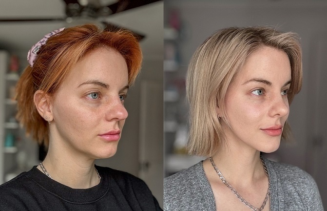 Сравнение внешности Хайди Мэй до и после подтяжки лица, ринопластики и кожных процедур (Предоставлено Хайди Мэй)