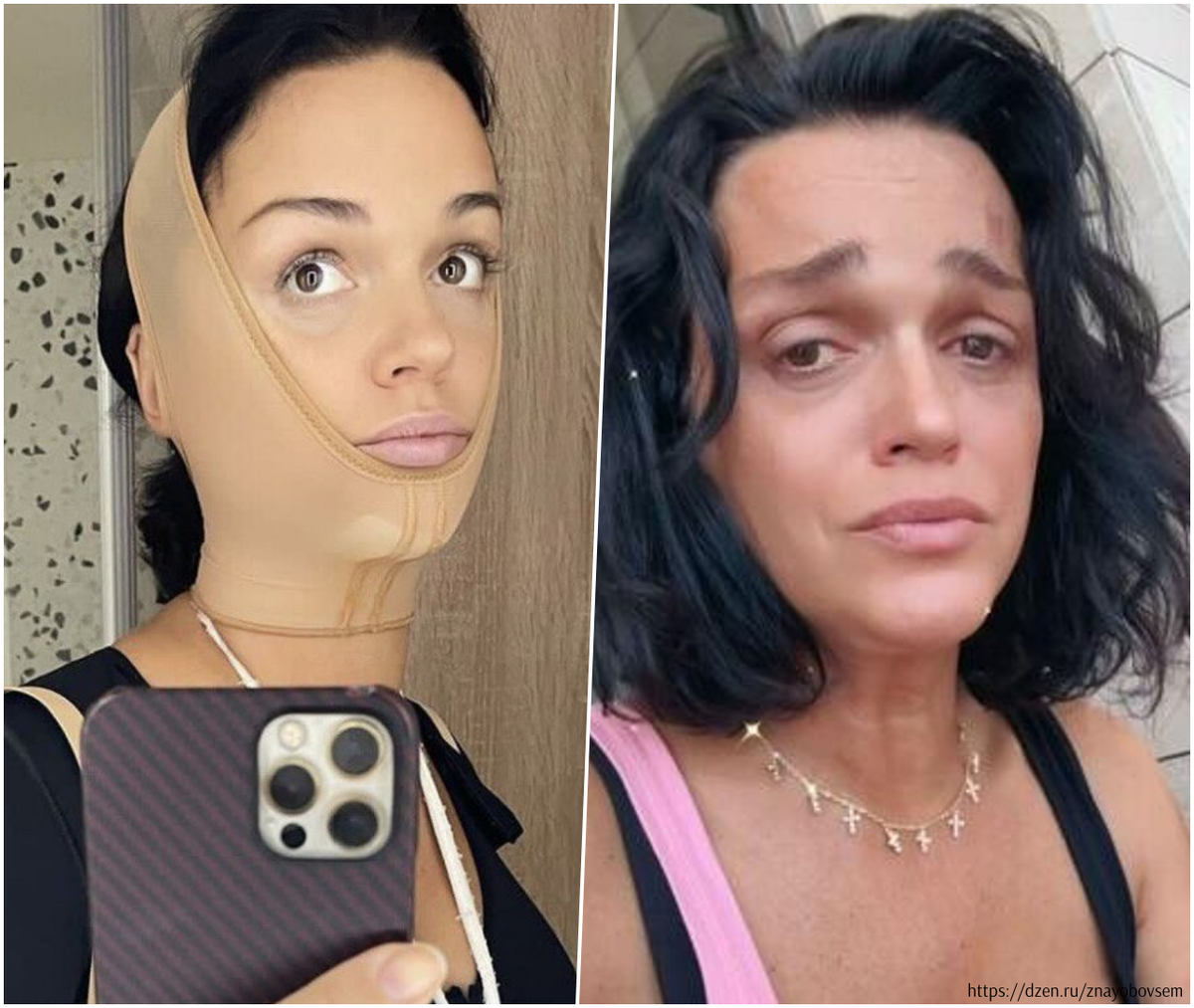 -2