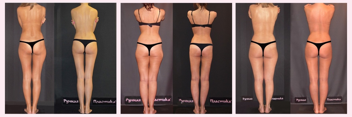 Центр Ручная Пластика Волынкина. Москва. 500 фото на сайте.