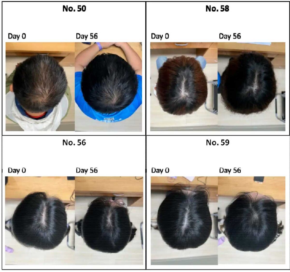    Значительные улучшения наблюдались у всех участников пятой группы / © Tsong-Min Chang et al. (2025)