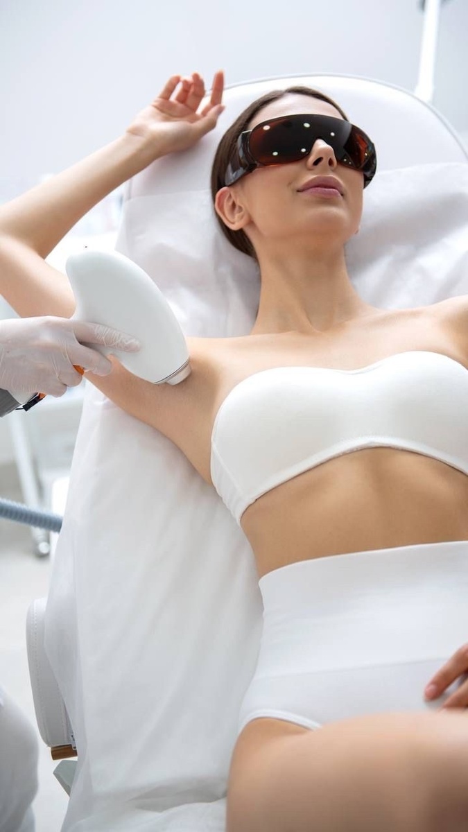 Лазерная эпиляция