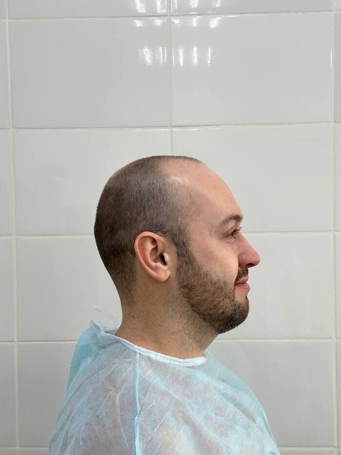 А вот сам пациент ДО