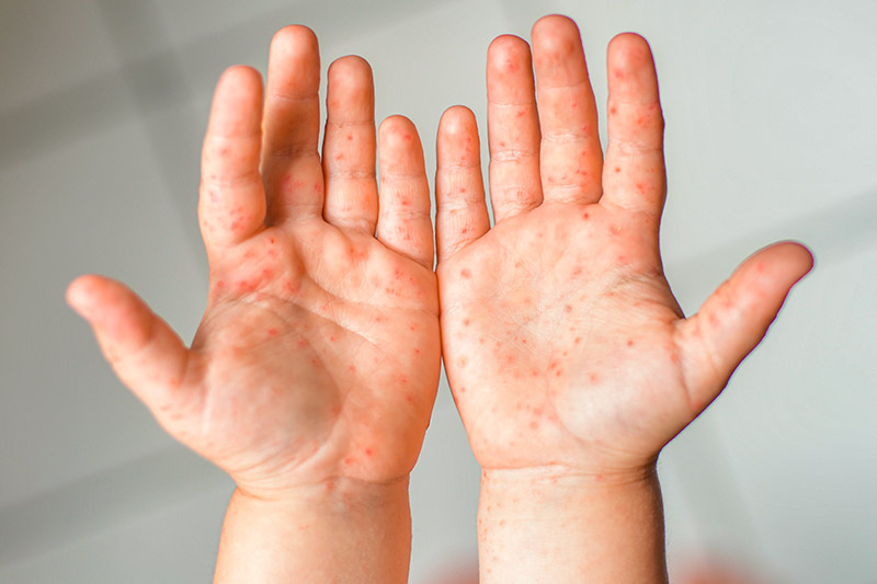    Shutterstock/FOTODOM