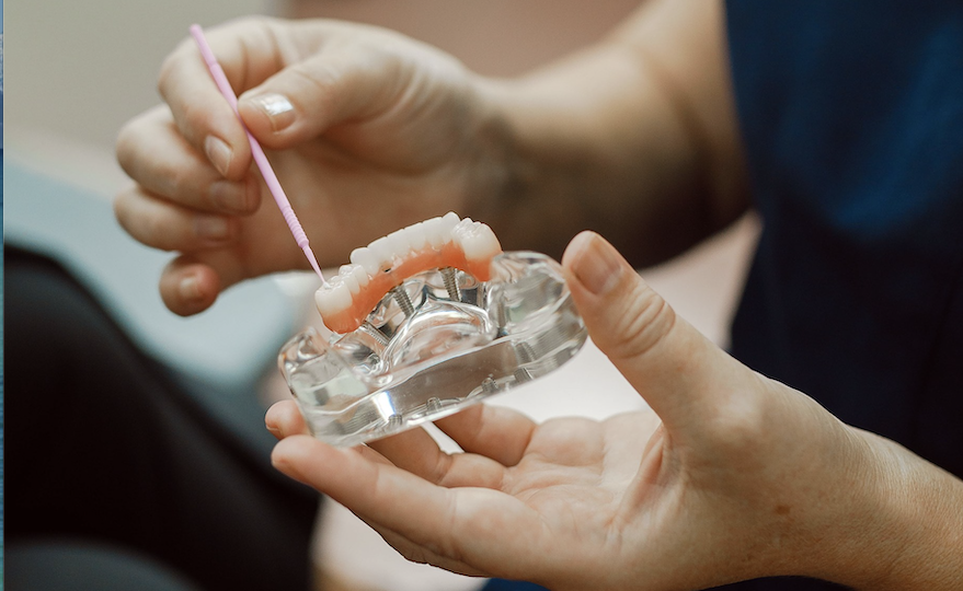 Почему All-on-6 не всегда «лучше», чем All-on-4?