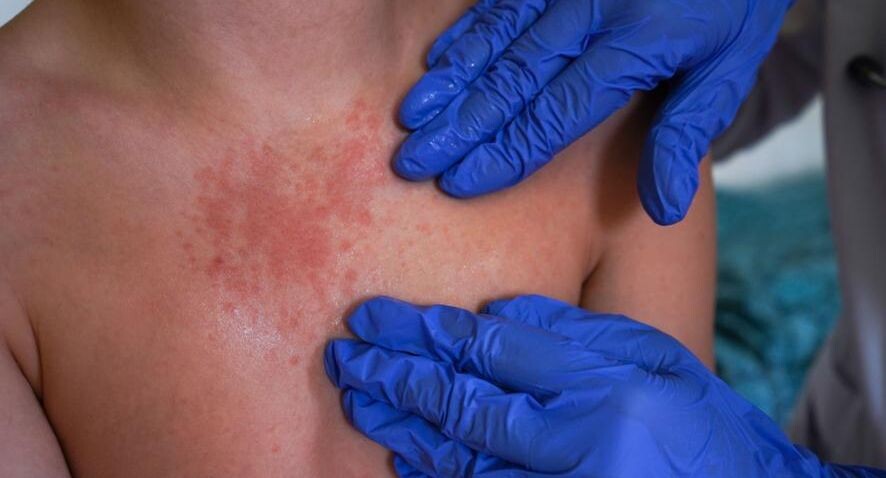    Кекяляйнен Андрей / Фотобанк Лори