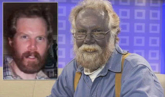 Нет, это не из нашей истории чувак. Это результат болезни. Но зато эта картинка хорошо демонстрирует то, какого цвета был посетитель магазина.