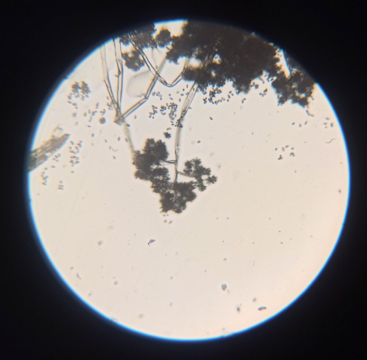 Botrytis cinerea при микроскопировании