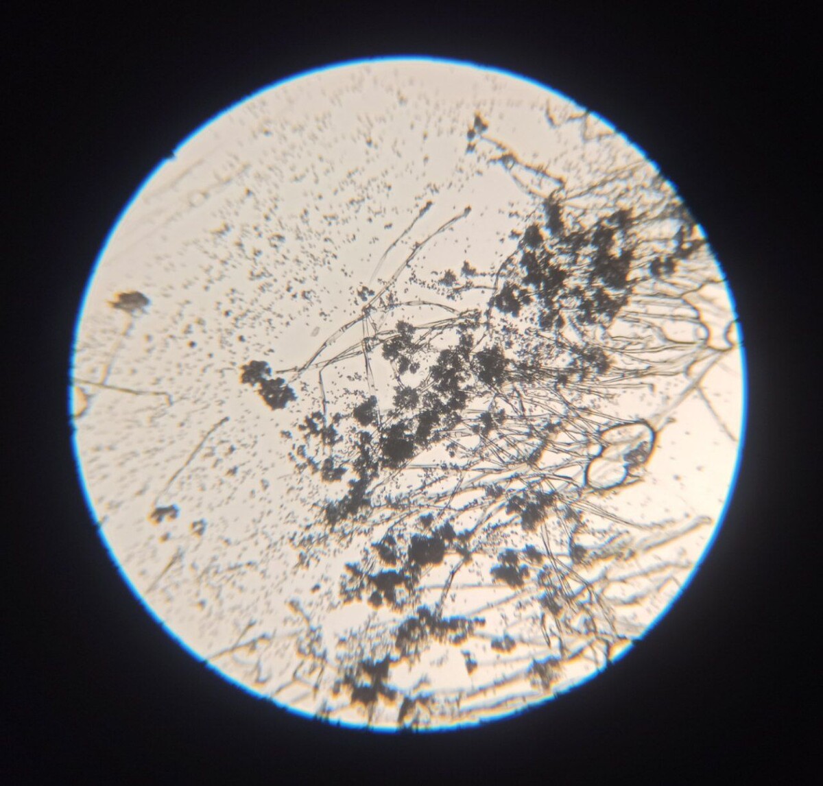 Botrytis cinerea при микроскопировании