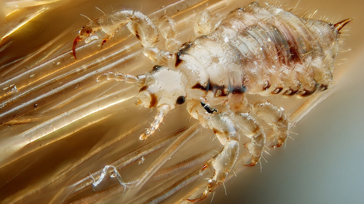 Фото с сайта: https://artjourney.ru/photo/lobkovaya-vosh-pod-mikroskopom-foto