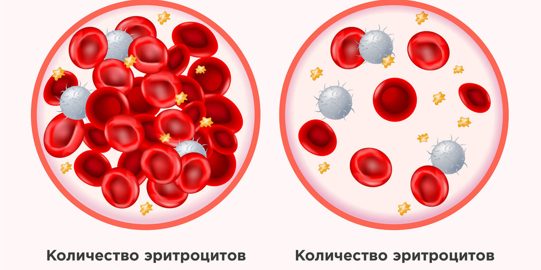 Биохимия крови: на какие 3 цифры смотрит врач в первую очередь (чек-лист)
