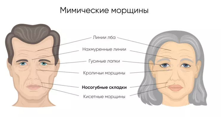 Как проявляются мимические морщины в старости