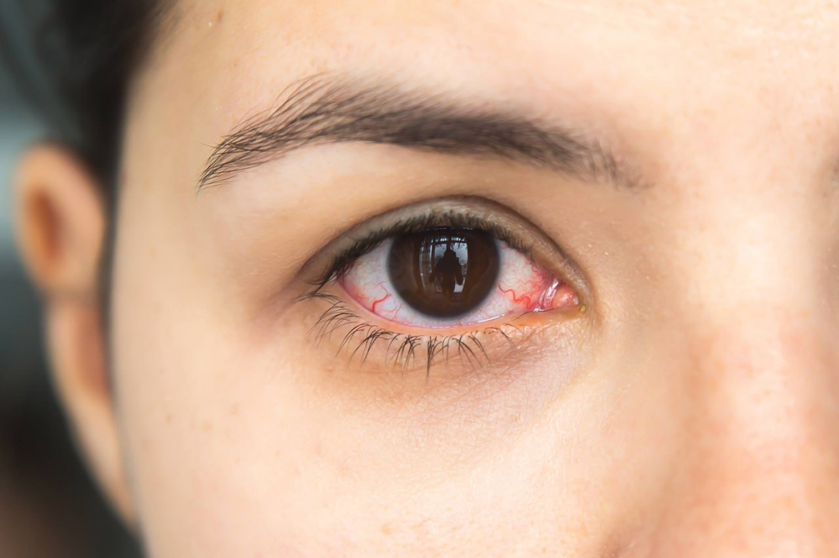 Фото: Zoonar/Imago/ТАСС