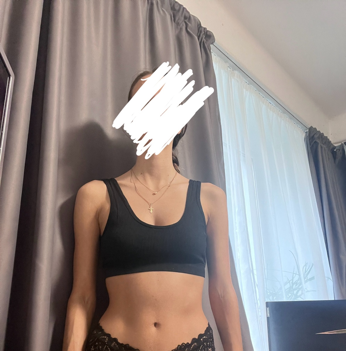 Посмотрите на талию. Видите какая разница? Это сколиоз 